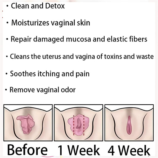 Dexcara Detox Repair, AnnieCare Natural Repair Vaginal Capsules, Anniecare Instant Anti YeeKeniO