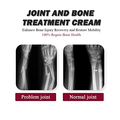 Joint Collagen Relieves Joint Soreness And Body Joint Care Collagen Get Thick Products Generic