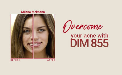 Delgado Protocol - DIM 855 Diindolylmethane Supplement - Improve Estrogen Balance