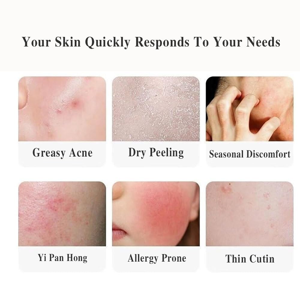 ATLION Women's Wild Yam Cream,Yam Cream for Pms & Menopause Relief for All Skin ATLION