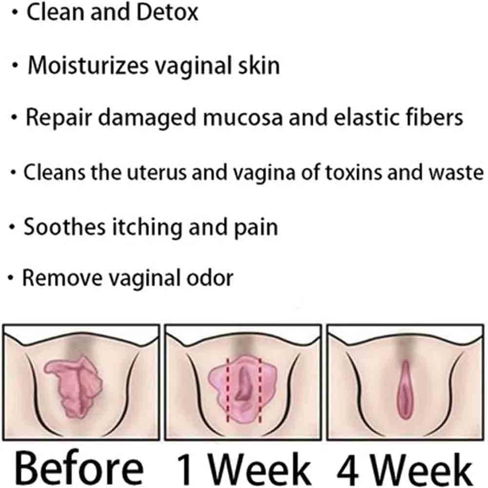 AnnieCare Instant Anti-Itch Detox Products, Annie Care Capsulas, Firming Repair & Pink Weabet