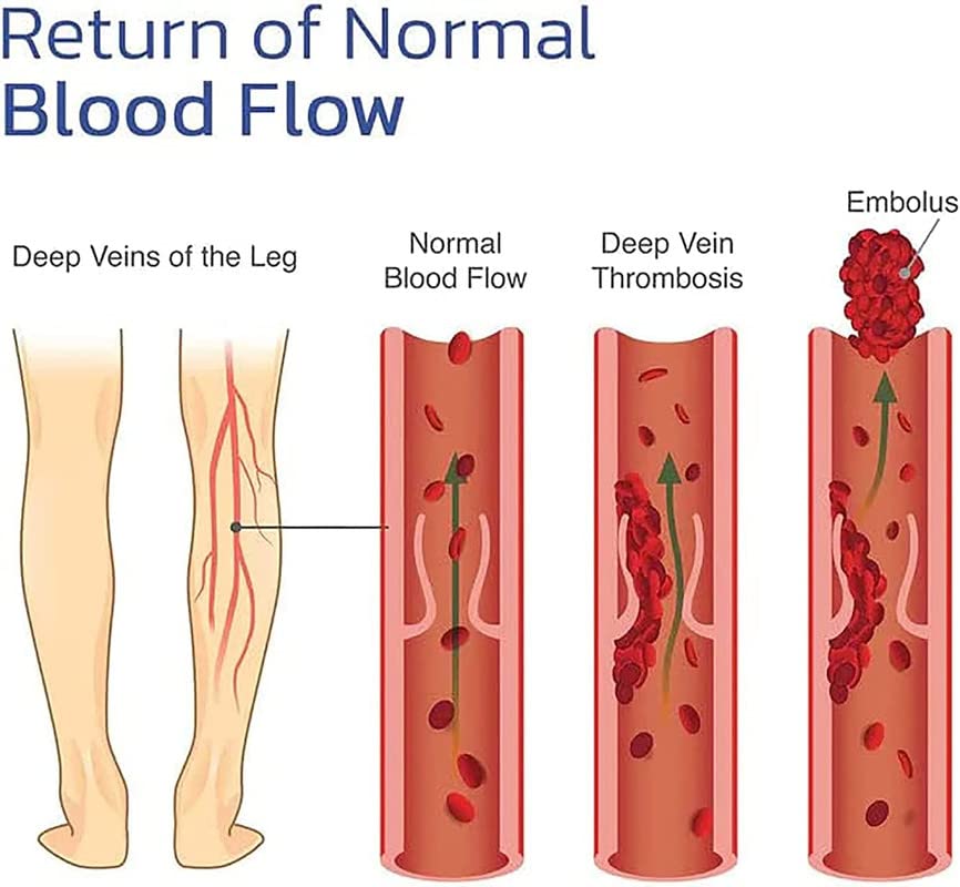 KNEECA Tourmaline Acupressure Selfheating Knee Sleeve, Tourmaline Acupressure Self XTRYTRUI