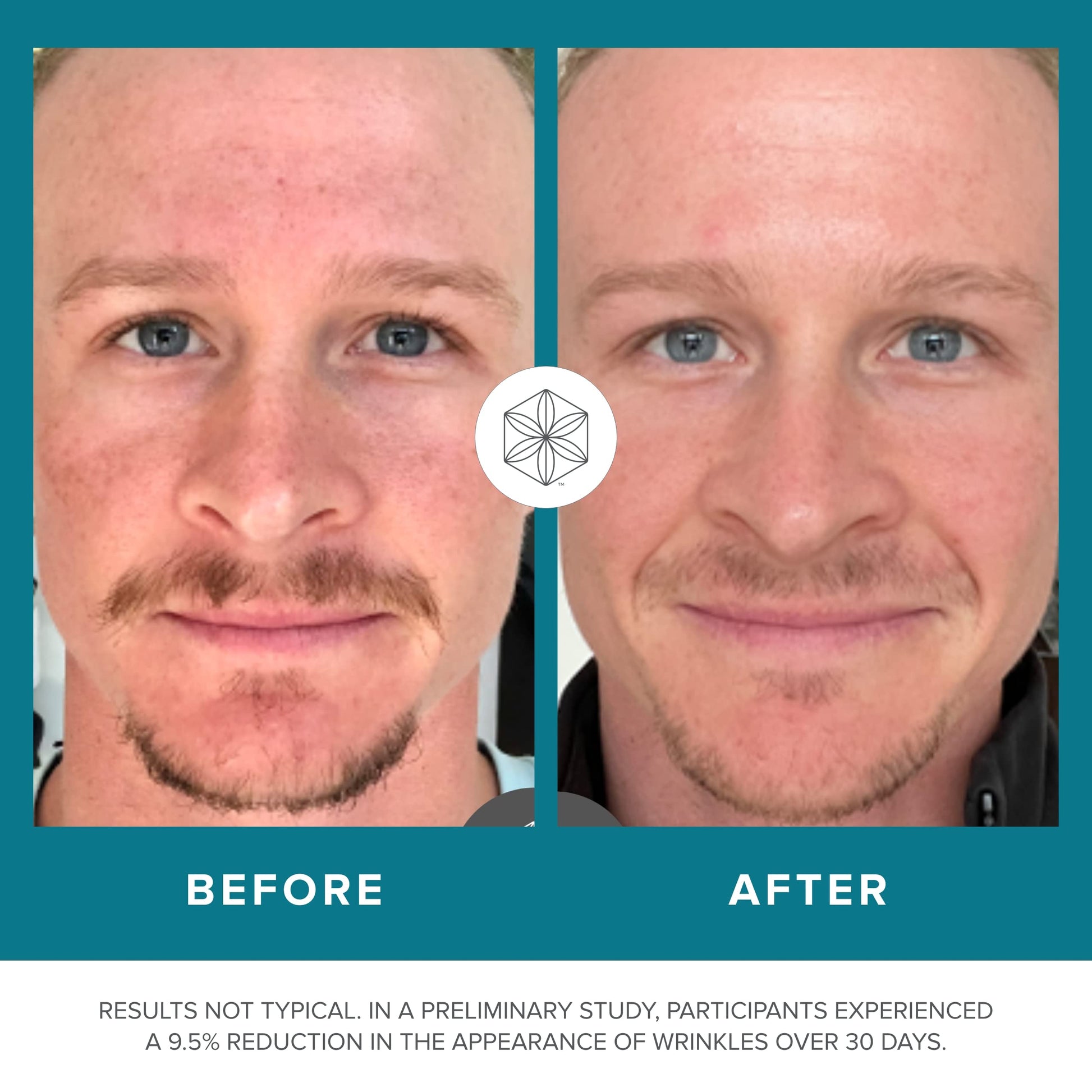 Isagenix Collagen Elixir - Collagen Drink with Marine Collagen Peptides - Liquid Collagen Isagenix