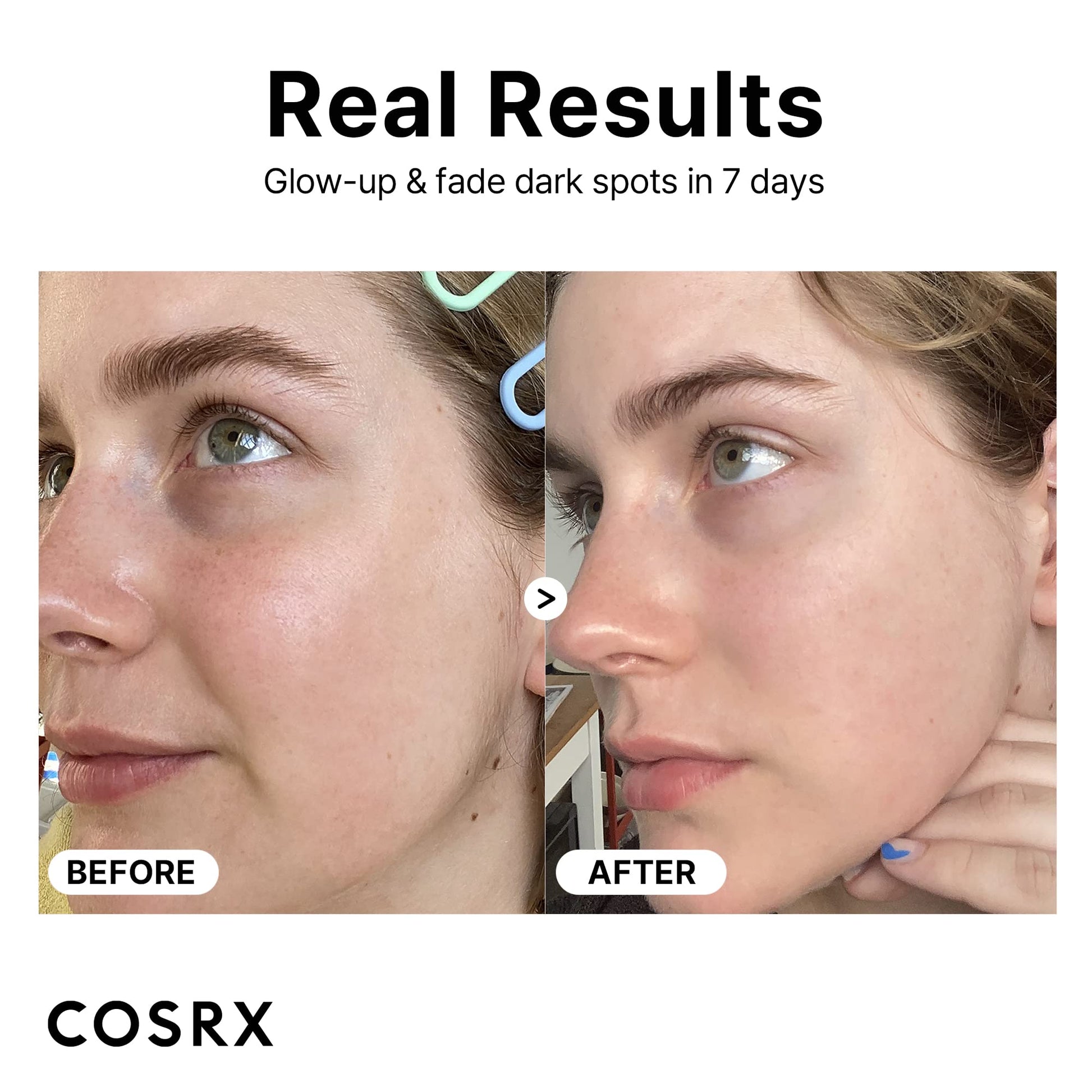 COSRX Pure Vitamin C Serum with Vitamin E & Hyaluronic Acid, Brightening COSRX