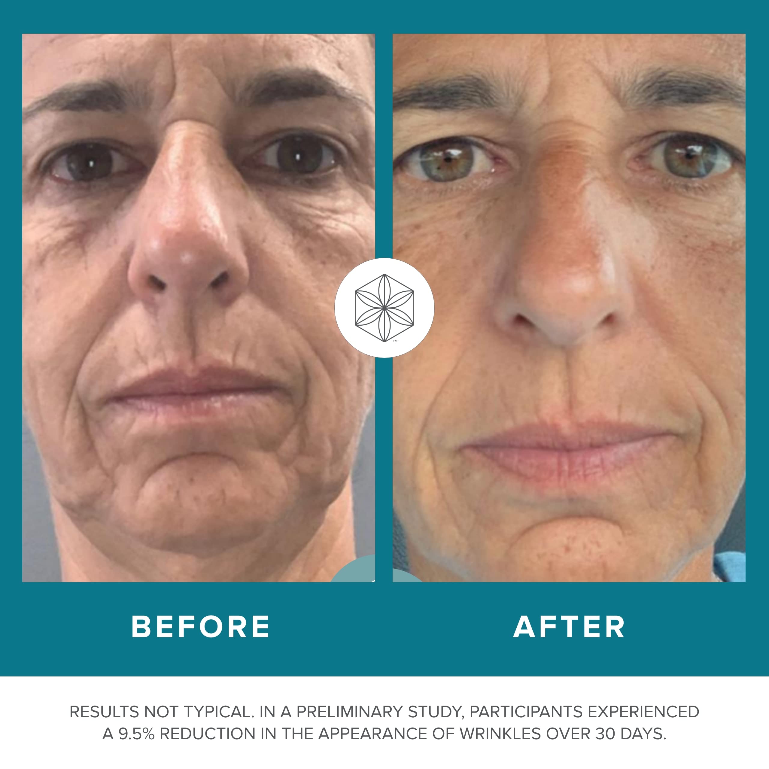 Isagenix Collagen Elixir - Collagen Drink with Marine Collagen Peptides - Liquid Collagen Isagenix