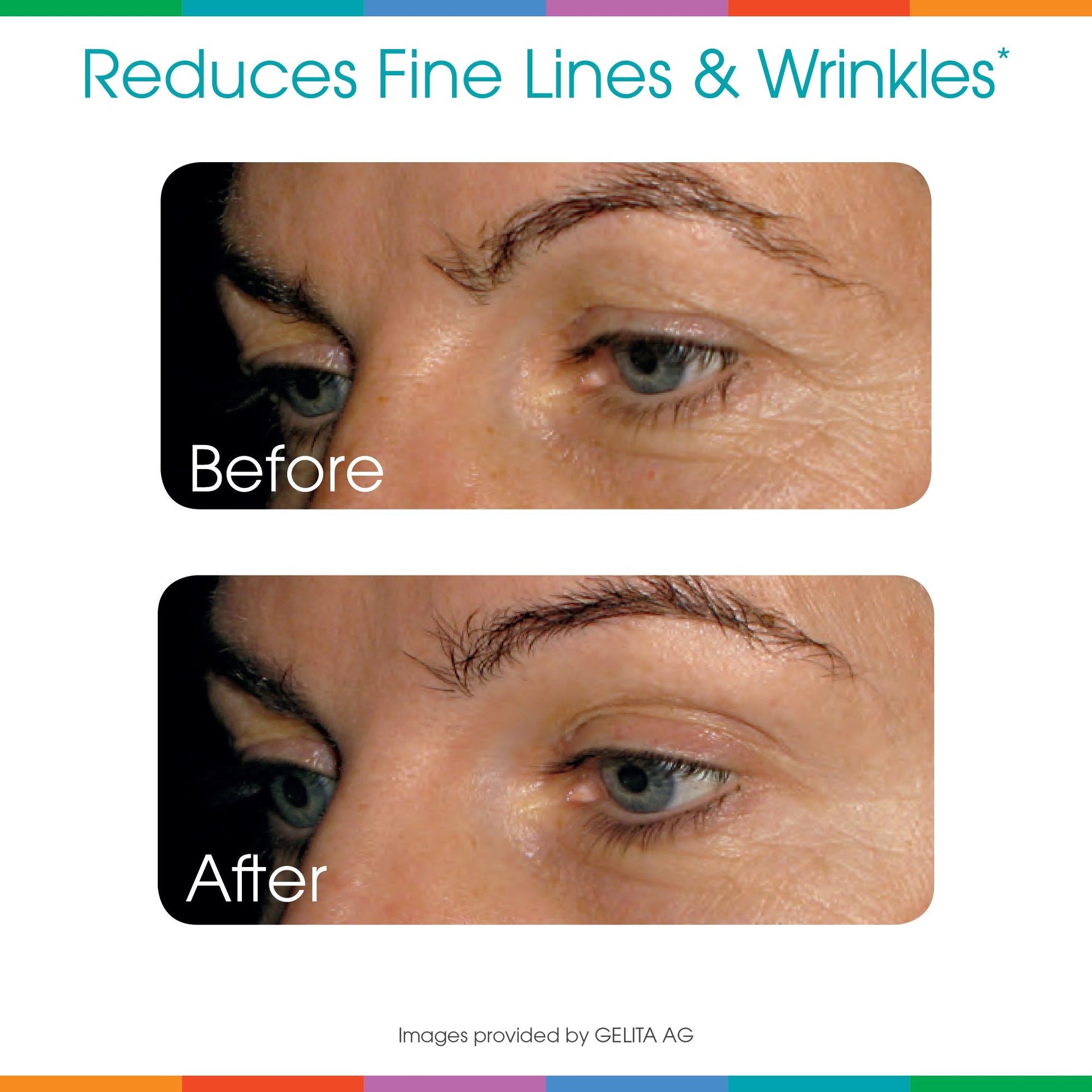 Hydrolyzed Collagen Powder - Sparkle Skin Boost Plus (No Flavor) [30-Serves] Verisol Pept Sparkle Collagen